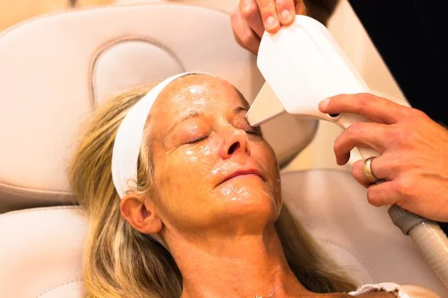 IPL+RF for Dry Eyes and Aesthetics